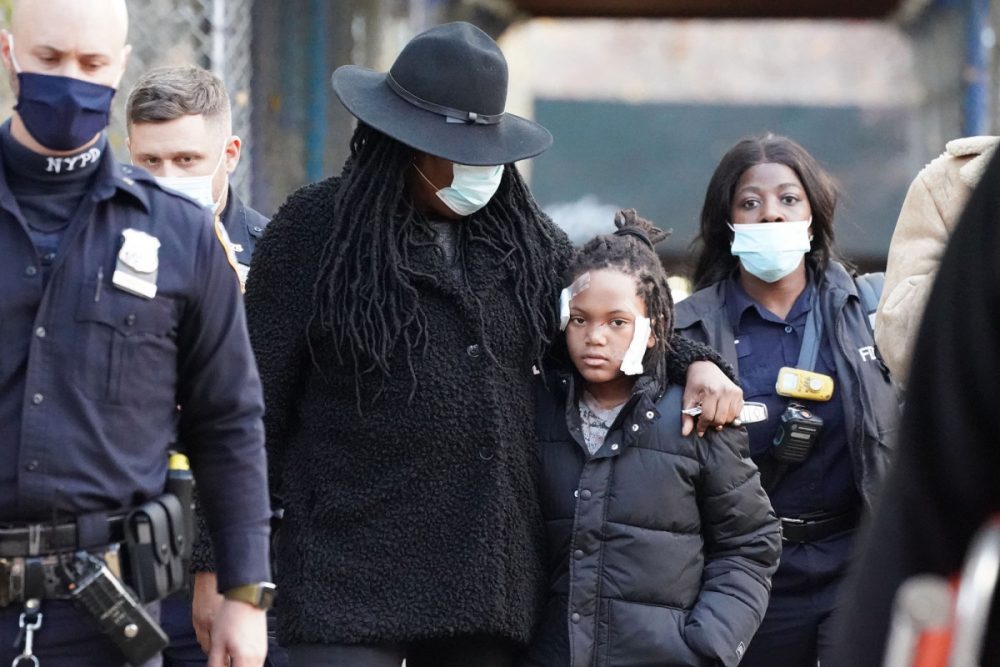 Woman slashes 10-year-old boy in the face after he answered his door