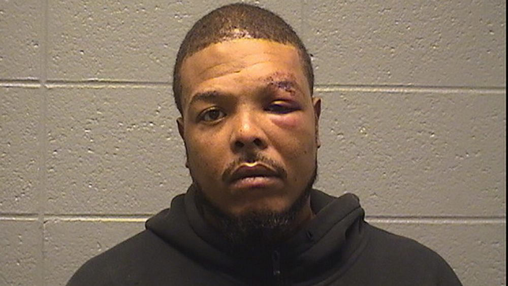 Man beat off-duty Chicago police officer and bit his friends nipple off