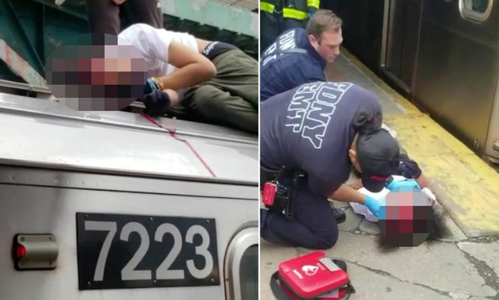 15-Year-Old In Critical Condition After Subway Surfing On NYC Train